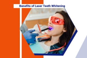 Benefits of Laser Teeth Whitening in Kolkata
