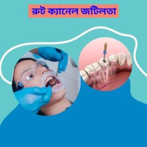 রুট ক্যানেল জটিলতা