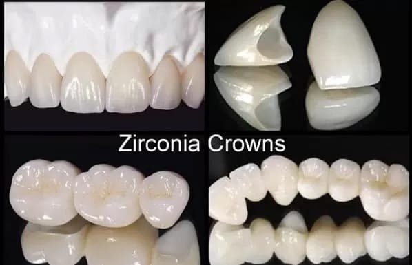 zirconia dental crown benefits