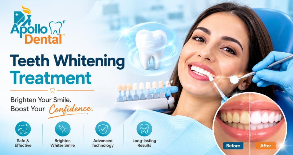 Teeth Whitening Treatment Clinic – Dr. Anuradha Bose, Apollo Dental